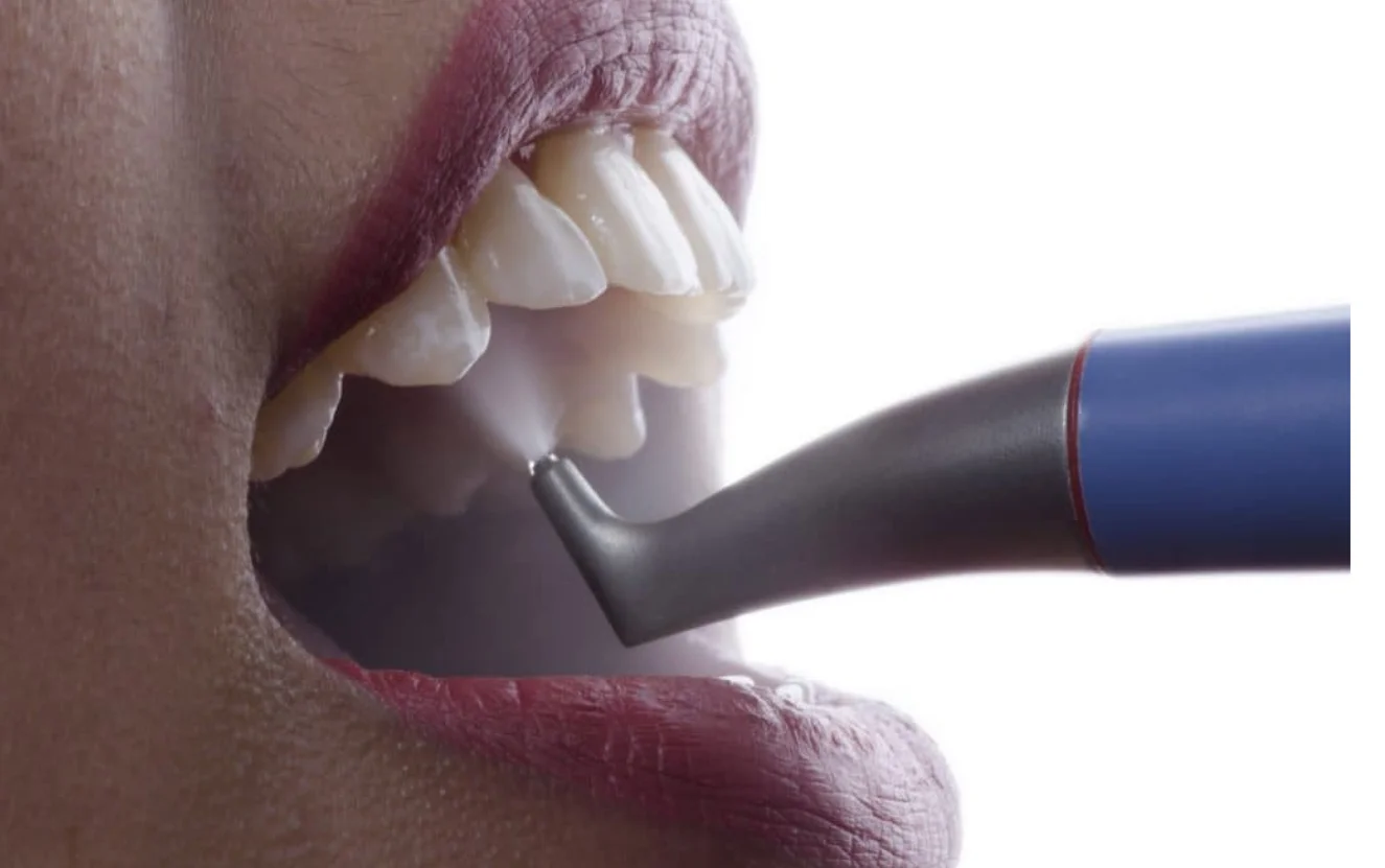 Dental Hygiene Bromley New Private Patients Consultations Announced at Smile 4 U Dental Practice